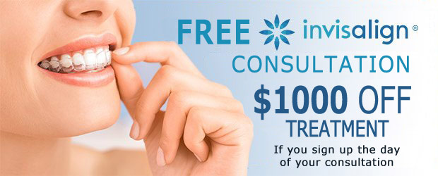 Invisalign Clear Aligners